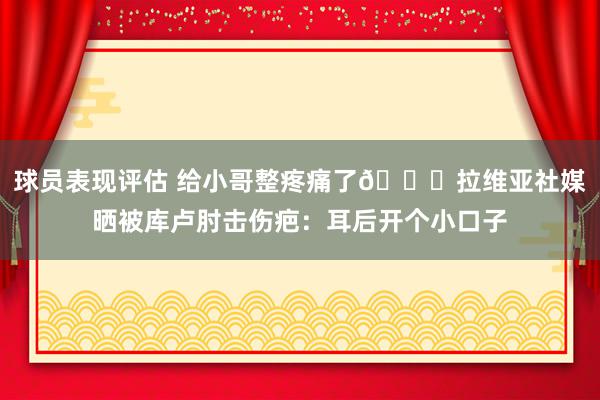 球员表现评估 给小哥整疼痛了😅拉维亚社媒晒被库卢肘击伤疤：耳后开个小口子